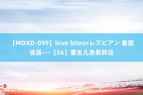 【MDXD-099】love bites×レズビアン 看图谈话---〖56〗重生儿急救转运